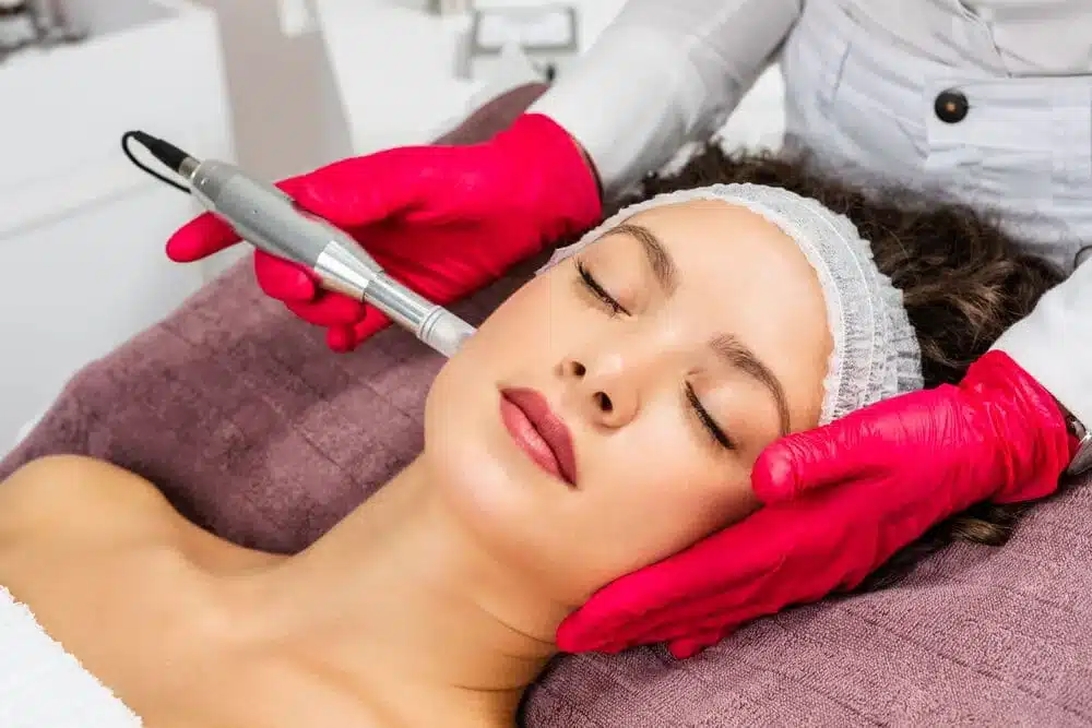 microneedling o mesoterapia facial