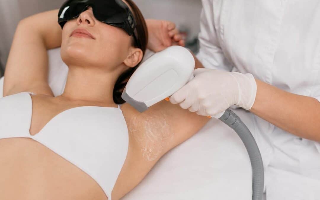 Woman wearing protective goggles receiving a laser hair removal treatment on her underarm covered in clear conductive gel.